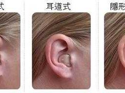 耳蜗助听器多少钱一个（耳蜗多少钱一个）